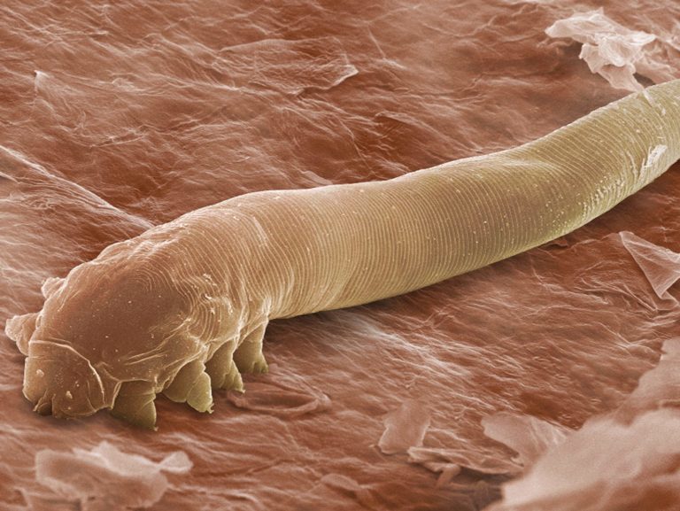 demodex wide aebabfbddbdbfffddac e
